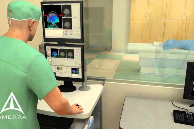 MRI-guided laser kills brain tumors without opening a patient's skull
