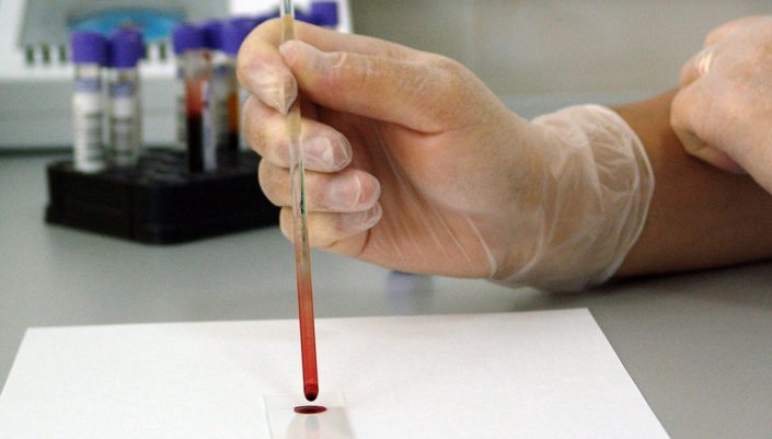 a hand uses a pipette to manipulate a blood sample